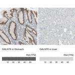 GALNT6 Antibody