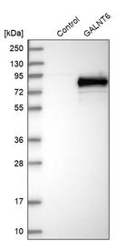 GALNT6 Antibody in Western Blot (WB)