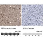 SEZ6 Antibody in Immunohistochemistry (IHC)