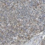 KAZALD1 Antibody in Immunohistochemistry (IHC)