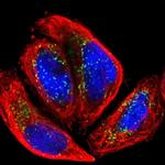 ACBD5 Antibody in Immunocytochemistry (ICC/IF)