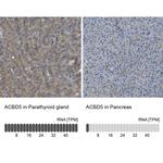 ACBD5 Antibody in Immunohistochemistry (IHC)