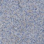 ACBD5 Antibody in Immunohistochemistry (IHC)