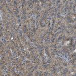 ACBD5 Antibody in Immunohistochemistry (IHC)