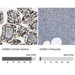 ACBD5 Antibody