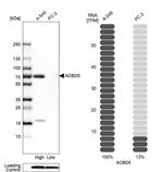 ACBD5 Antibody in Western Blot (WB)