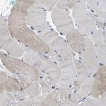 Cullin 4B Antibody in Immunohistochemistry (IHC)