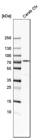 IGSF8 Antibody in Western Blot (WB)