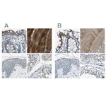 STBD1 Antibody in Immunohistochemistry (IHC)