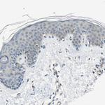 STBD1 Antibody in Immunohistochemistry (IHC)