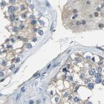 STBD1 Antibody in Immunohistochemistry (IHC)