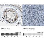 PARN Antibody in Immunohistochemistry (IHC)