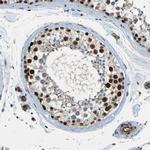 PARN Antibody in Immunohistochemistry (IHC)