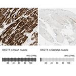 OXCT1 Antibody in Immunohistochemistry (IHC)