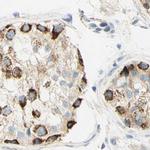 OXCT1 Antibody in Immunohistochemistry (IHC)