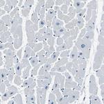 PHKG1 Antibody in Immunohistochemistry (IHC)