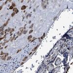 LEPRE1 Antibody in Immunohistochemistry (IHC)