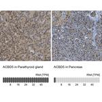 ACBD5 Antibody in Immunohistochemistry (IHC)