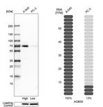 ACBD5 Antibody in Western Blot (WB)