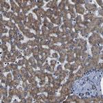 INPP5A Antibody in Immunohistochemistry (IHC)