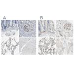 CD93 Antibody in Immunohistochemistry (IHC)