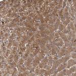 FBP1/FBP2 Antibody in Immunohistochemistry (IHC)