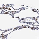 FBP1/FBP2 Antibody in Immunohistochemistry (IHC)