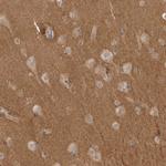 NRCAM Antibody in Immunohistochemistry (IHC)