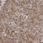 NRCAM Antibody in Immunohistochemistry (IHC)