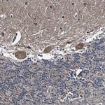 GALNT8 Antibody in Immunohistochemistry (IHC)