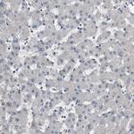 GALNT8 Antibody in Immunohistochemistry (IHC)