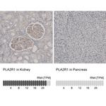 PLA2R1 Antibody