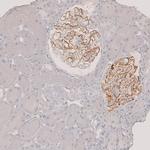 PLA2R1 Antibody in Immunohistochemistry (IHC)