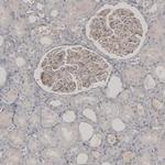 PLA2R1 Antibody in Immunohistochemistry (IHC)