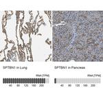 SPTBN1 Antibody