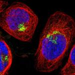 SPTBN1 Antibody in Immunocytochemistry (ICC/IF)