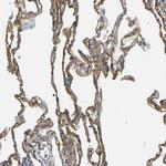 SPTBN1 Antibody in Immunohistochemistry (IHC)