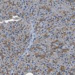 SPTBN1 Antibody in Immunohistochemistry (IHC)