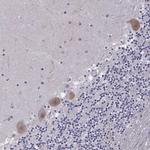 FGF3 Antibody in Immunohistochemistry (IHC)