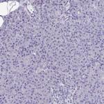 OMG Antibody in Immunohistochemistry (IHC)