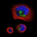 PTPRF Antibody in Immunocytochemistry (ICC/IF)