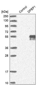 DPEP1 Antibody in Western Blot (WB)