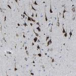 PLD3 Antibody in Immunohistochemistry (IHC)