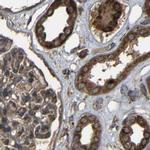 C1GALT1 Antibody in Immunohistochemistry (IHC)