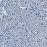 ZMAT1 Antibody in Immunohistochemistry (IHC)