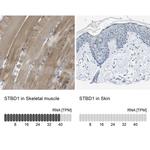 STBD1 Antibody in Immunohistochemistry (IHC)