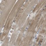 STBD1 Antibody in Immunohistochemistry (IHC)