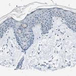 STBD1 Antibody in Immunohistochemistry (IHC)