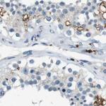 STBD1 Antibody in Immunohistochemistry (IHC)