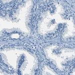 Fibrillin 2 Antibody in Immunohistochemistry (IHC)